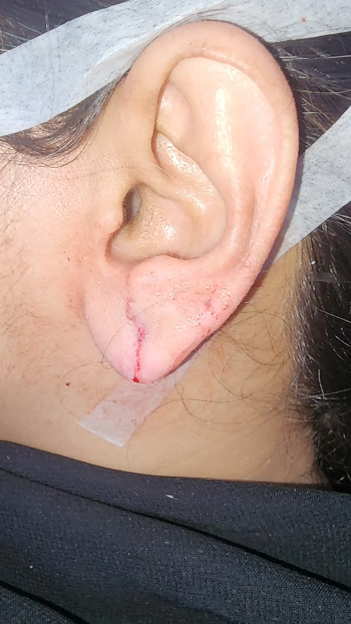 Patients 10 After