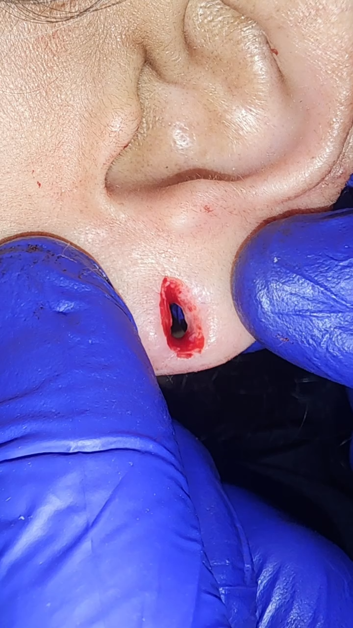 Patients 10 Before
