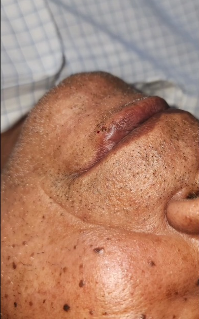 Patients 11 After