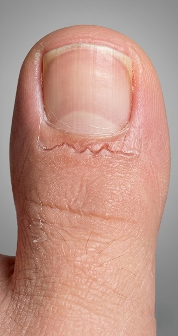 Patients 6 After