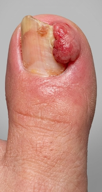 Patients 6 Before
