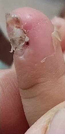 Patients 7 After