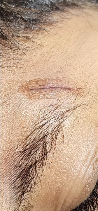 Patients 9 After
