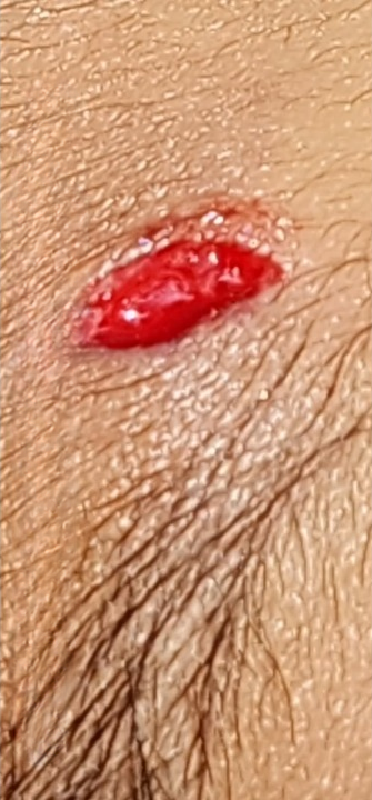 Patients 9 Before
